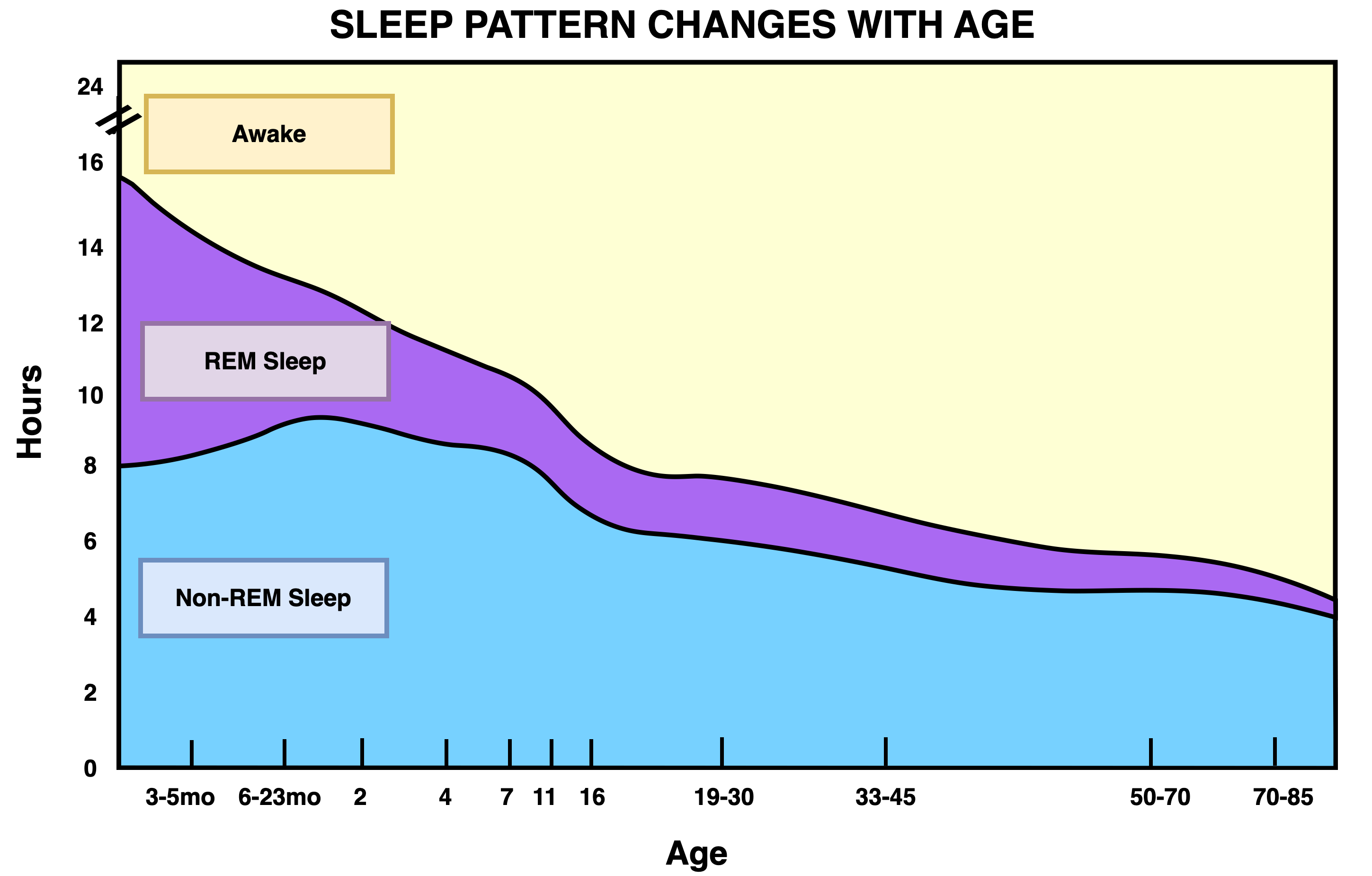 Unlocking the Mysteries: Decoding PSG Readings for REM Sleep Cycles ...
